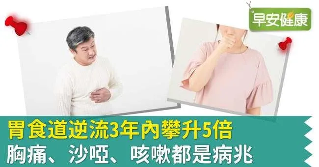 胃食道逆流3年內攀升5倍，胸痛、沙啞、咳嗽都是病兆