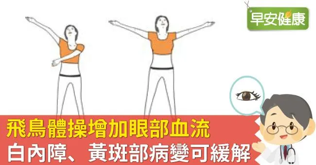 飛鳥體操增加眼部血流，白內障、黃斑部病變可緩解