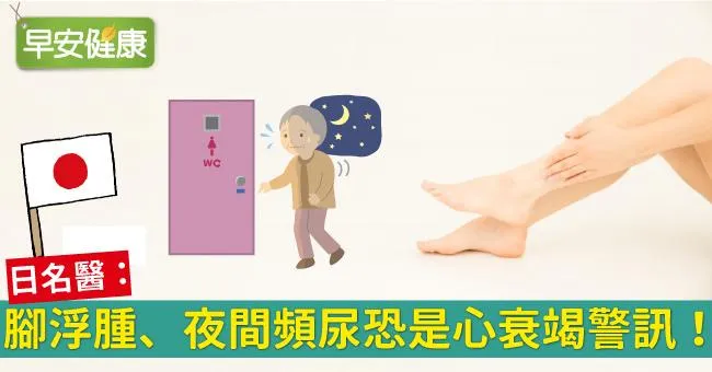 腳浮腫、夜間頻尿恐是心衰竭警訊！