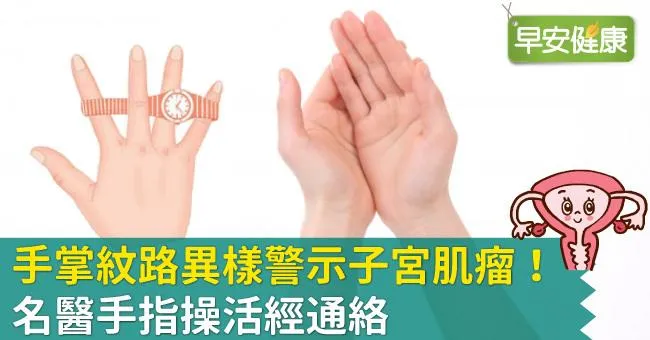 手掌紋路異樣警示子宮肌瘤！名醫手指操活經通絡