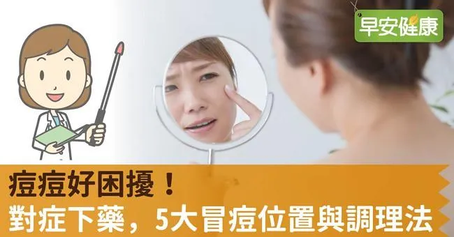從痘痘位置看身體哪裡生病！5個冒痘位置如何對症下藥？