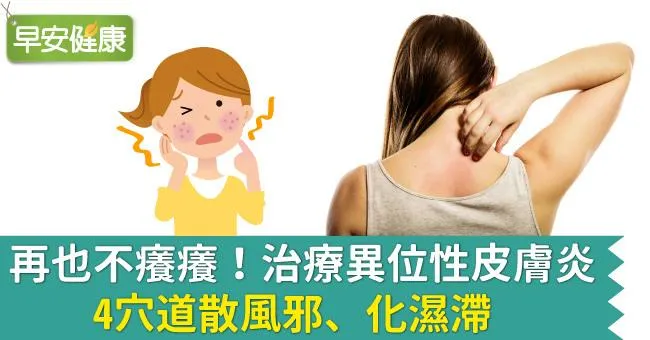再也不癢癢！治療異位性皮膚炎，4穴道散風邪、化濕滯