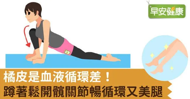 橘皮是血液循環差！蹲著鬆開髖關節暢循環又美腿