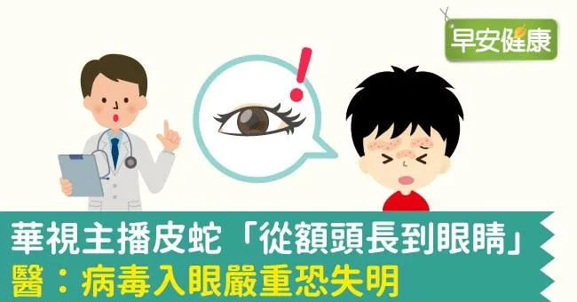 華視主播皮蛇「從額頭長到眼睛」！醫：病毒入眼嚴重恐失明