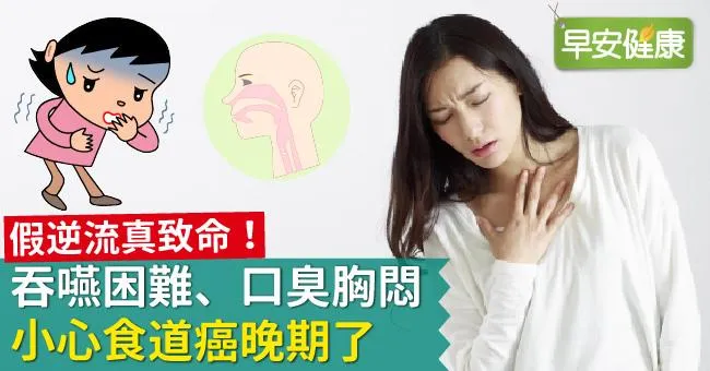 假逆流真致命！吞嚥困難、口臭胸悶，小心食道癌晚期了