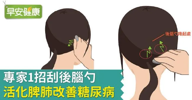 專家1招刮後腦勺，活化脾肺改善糖尿病！