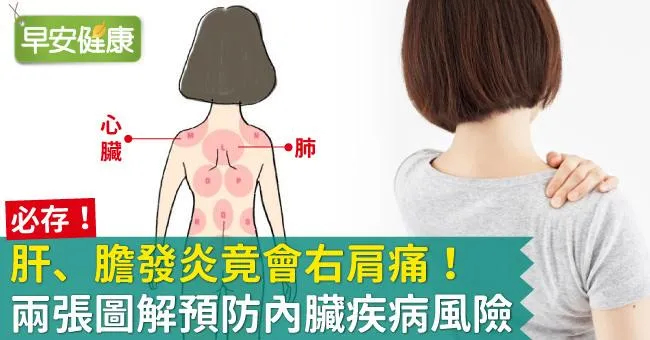 肝、膽發炎竟會右肩痛！兩張圖解預防內臟疾病風險