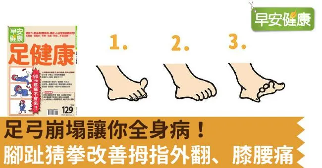 足弓崩塌讓你全身病！腳趾猜拳改善拇指外翻、膝腰痛