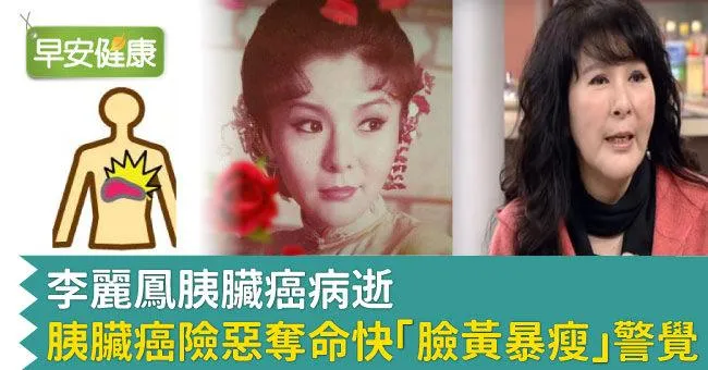李麗鳳胰臟癌病逝，胰臟癌險惡奪命快「臉黃暴瘦」警覺