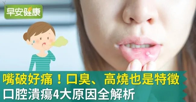 口腔潰瘍，嘴巴破洞變白色？遠離口腔發炎潰瘍，你可以這樣做
