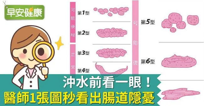 沖水前看一眼！醫師1張圖秒看出腸道隱憂