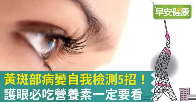 黃斑部病變自我檢測5招！護眼必吃營養素一定要看