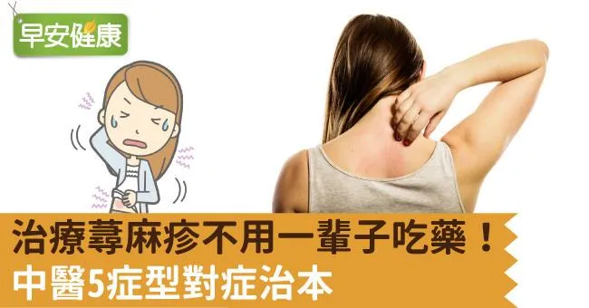 治療蕁麻疹不用一輩子吃藥！中醫5症型對症治本