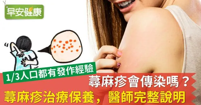 蕁麻疹讓全身紅腫癢？蕁麻疹治療保養，醫師完整說明