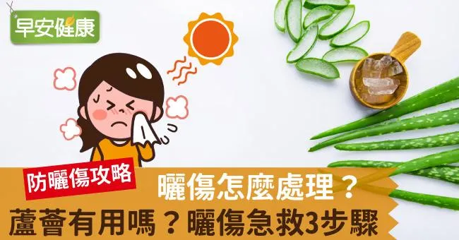 曬傷怎麼處理？蘆薈有用嗎？曬傷急救3步驟