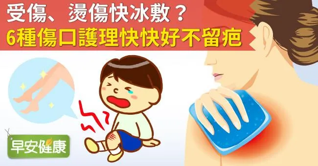 受傷、燙傷快冰敷？6種傷口護理快快好不留疤