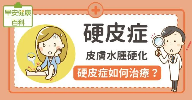 硬皮症：皮膚水腫硬化，硬皮症如何治療？