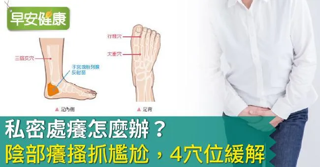 私密處癢怎麼辦？陰部癢搔抓尷尬，4穴位緩解