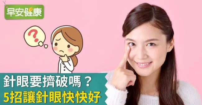 針眼要擠破嗎？5招讓針眼快快好