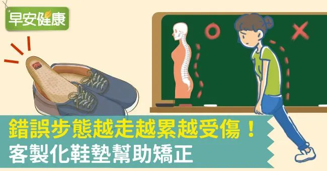 錯誤步態越走越累越受傷！客製化鞋墊幫助矯正