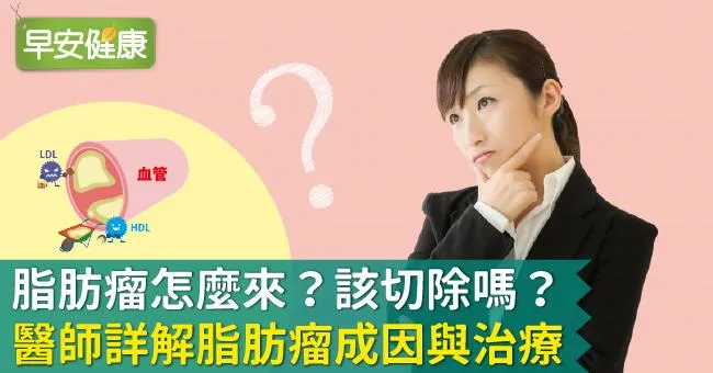 脂肪瘤怎麼來？該切除嗎？醫師詳解脂肪瘤成因與治療