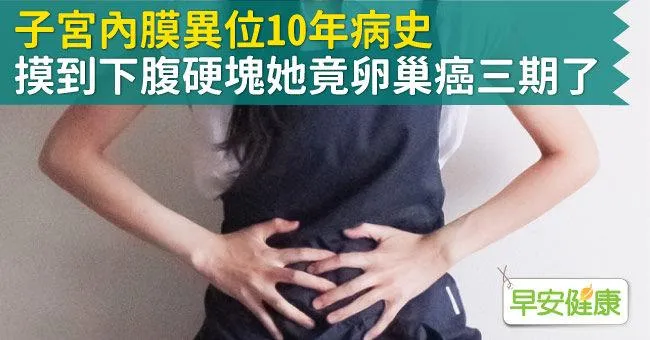 子宮內膜異位10年病史，摸到下腹硬塊她竟卵巢癌三期了