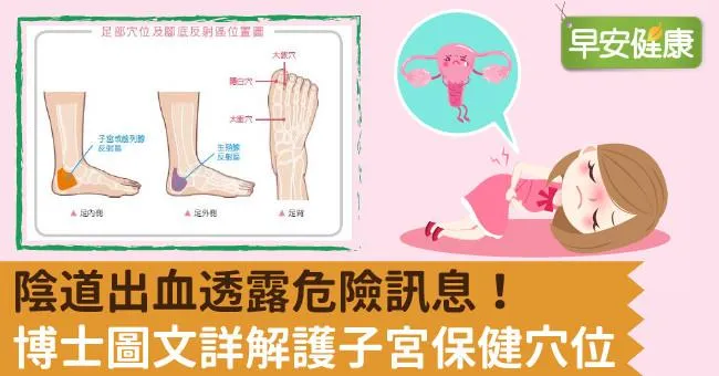 陰道出血透露危險訊息！博士圖文詳解護子宮保健穴位