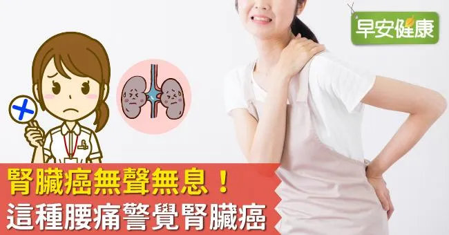 腎臟癌無聲無息！這種腰痛警覺腎臟癌