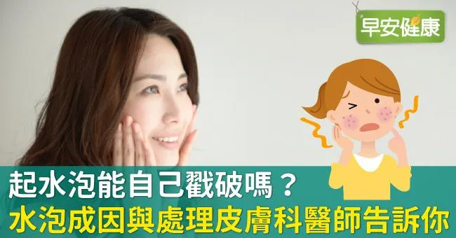 起水泡能自己戳破嗎？水泡成因與處理皮膚科醫師告訴你