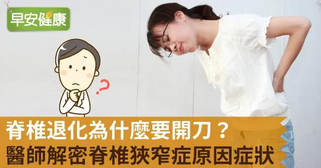 脊椎退化為什麼要開刀？醫師解密脊椎狹窄症原因症狀