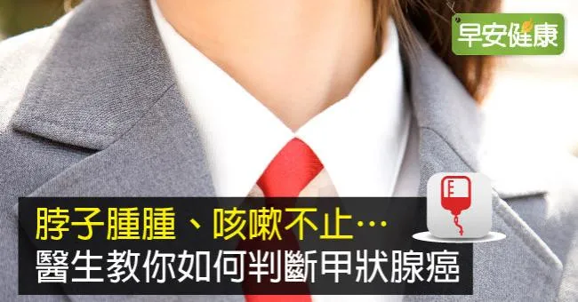 甲狀腺結節會變成癌症嗎？醫師教你判斷症狀！