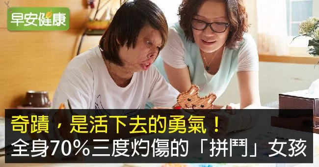 奇蹟，是活下去的勇氣！全身70％三度灼傷的「拼鬥」女孩
