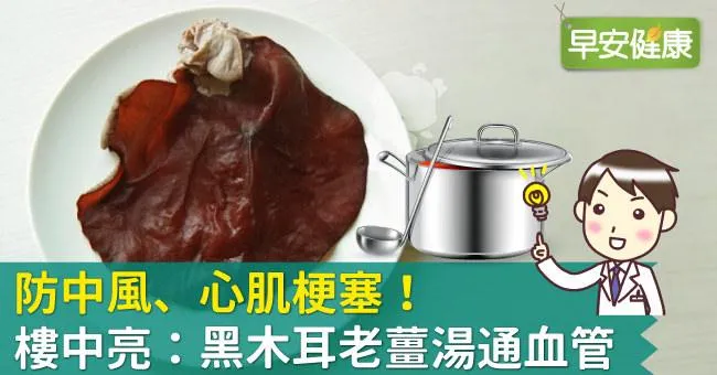 防中風、心肌梗塞！樓中亮：黑木耳老薑湯通血管