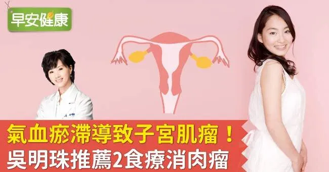 氣血瘀滯導致子宮肌瘤！吳明珠推薦2食療消肉瘤