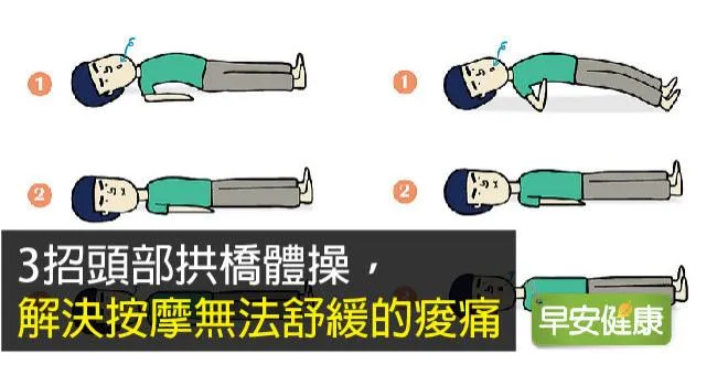 3招頭部拱橋體操，解決按摩無法舒緩的痠痛