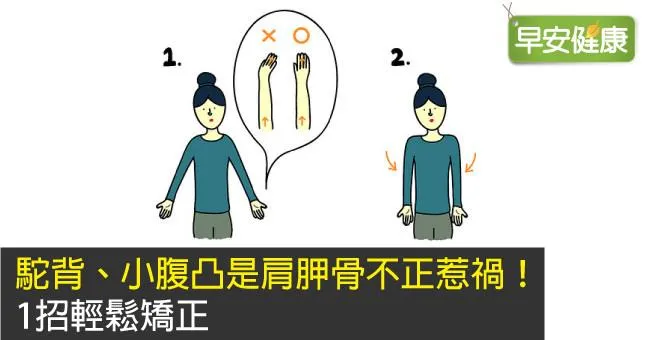 駝背、小腹凸是肩胛骨不正惹禍！1招輕鬆矯正