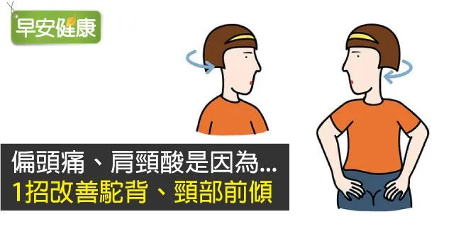 偏頭痛、肩頸酸是因為...1招改善駝背、頸部前傾