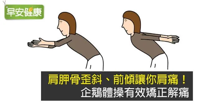 肩胛骨歪斜、前傾讓你肩痛！企鵝體操有效矯正解痛