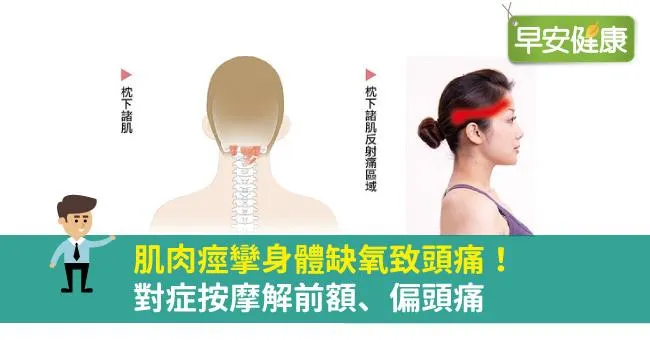 肌肉痙攣身體缺氧致頭痛！對症按摩解前額、偏頭痛