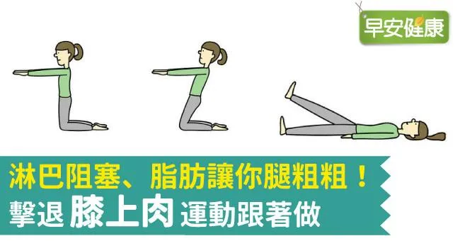 淋巴阻塞、脂肪讓你腿粗粗！擊退膝上肉運動跟著做