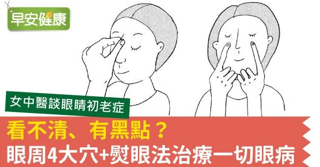 看不清、有黑點？眼周4大穴+熨眼法治療一切眼病