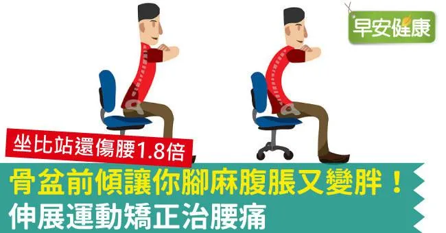 骨盆前傾讓你腳麻腹脹又變胖！伸展運動矯正治腰痛