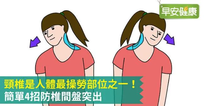 頸椎是人體最操勞部位之一！簡單4招防椎間盤突出