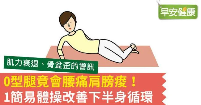 O型腿竟會腰痛肩膀痠！1簡易體操改善下半身循環