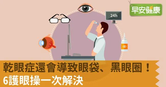 乾眼症還會導致眼袋、黑眼圈！6護眼操一次解決