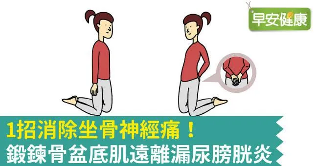 1招消除坐骨神經痛！鍛鍊骨盆底肌遠離漏尿膀胱炎