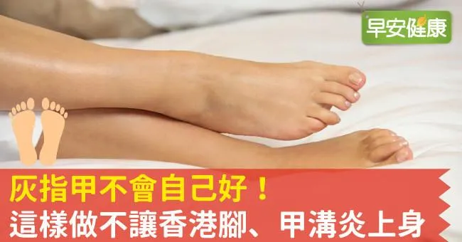 灰指甲不會自己好！這樣做不讓香港腳、甲溝炎上身