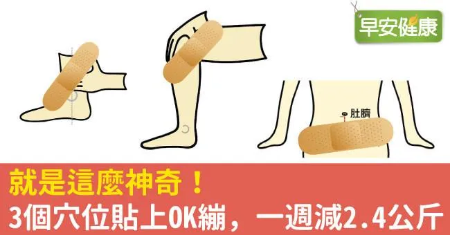 就是這麼神奇！3個穴位貼上OK繃，一週減2.4公斤