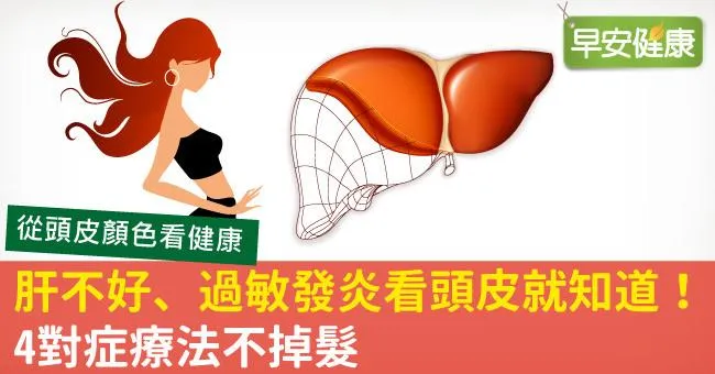 肝不好、過敏發炎看頭皮就知道！4對症療法不掉髮