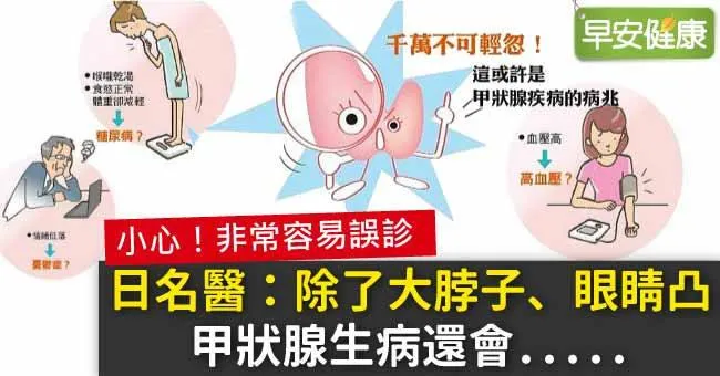 甲狀腺生病不只眼凸脖子腫！日名醫1表關鍵徵兆一次看懂